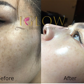 IGlow Beauty Center
