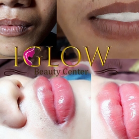 IGlow Beauty Center