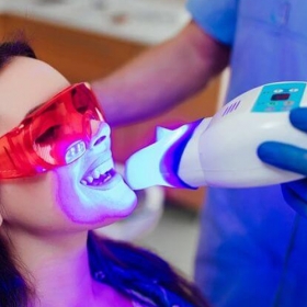 Tẩy trắng răng bằng công nghệ Laser- Whitening không ê buốt tại Smile Beauty