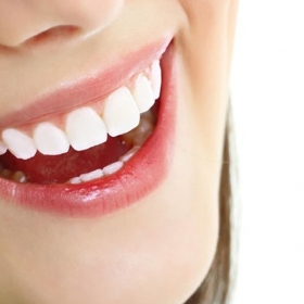 Bọc răng sứ Zirconia bền, đẹp, chống mài mòn chính hãng từ Đức tại Smile Beauty