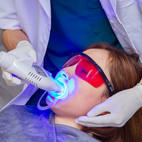 Tẩy trắng răng công nghệ Whitening tại Miley Dental