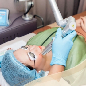 Blossom Beauty Medical Center - Laser toning trẻ hoá điều trị sắc tố da