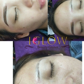 IGlow Beauty Center