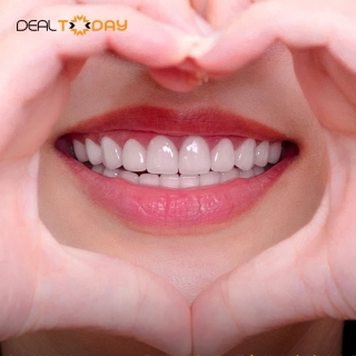 Hệ thống Nha Khoa Quốc Tế Winsmile - Ưu đãi 50% hàn trám răng sâu
