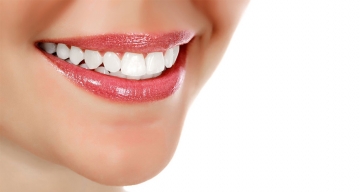 Lấy cao răng đánh bóng giá siêu ưu đãi tại Nha khoa Văn Chương