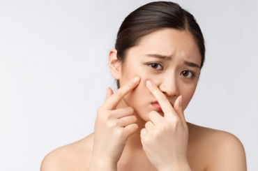 Trị mụn chuẩn y khoa - Giải pháp an toàn cho làn da khỏe đẹp