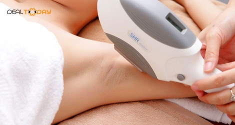 05 buổi triệt lông vùng nách hoặc mép hoặc cằm công nghệ Elight tại Mervyn Spa