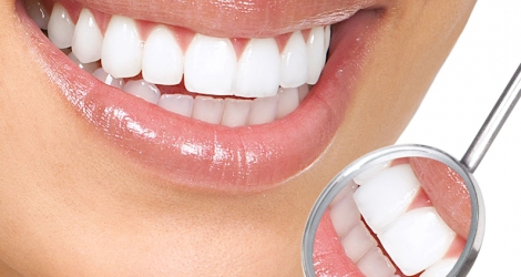 Nha khoa Bebeauty - Răng toàn sứ Zirconia của Đức - Bảo hành 15 năm