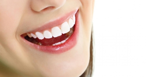Bọc răng sứ Venus tại Nha khoa Văn Chương - Bảo hành 10 năm