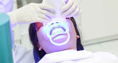Tẩy trắng răng bằng Laser tại Nha khoa Tâm Phúc
