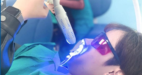 Tẩy trắng răng Laser Whitening tại hệ thống nha khoa Quốc tế Lamina
