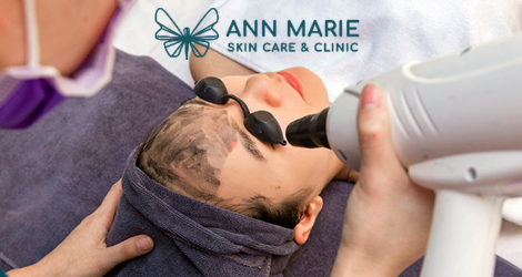 Thẻ quà tặng trị giá 200k áp dụng tại Ann Marie - Skin Care & Clinic