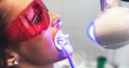 Tẩy trắng răng công nghệ độc quyền Mỹ tại Nha Khoa Dr Bảo Hưng