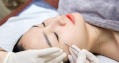 Trị mụn chuyên sâu tại Spa Đông Y Ngọc Hà