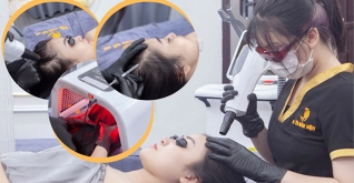 Nuôi cấy tế bào mầm tóc công nghệ Hoa Kỳ tại Viện thẩm mỹ 168