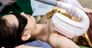 Triệt lông công nghệ SHR không đau rát tại Spa Đông Y Ngọc Hà