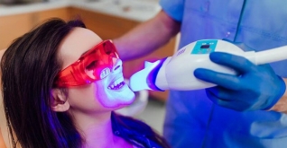 Tẩy trắng răng bằng công nghệ Laser- Whitening không ê buốt tại Smile Beauty