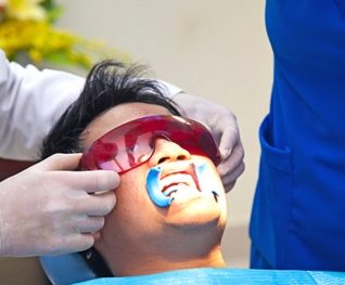 Tẩy trắng răng bằng đèn Bleach Bright - Hệ thống nha khoa Quốc tế KDA