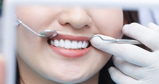 Răng toàn sứ Cercon của Đức tại Nha Khoa Tâm Dental