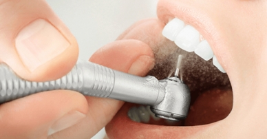 Dịch vụ chăm sóc răng miệng, lấy cao răng tại nha khoa Thanh Phương.
