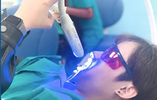 Tẩy trắng răng Laser Whitening tại hệ thống nha khoa Quốc tế Lamina