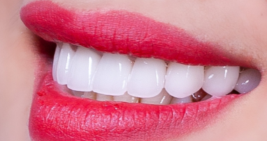 Răng sứ cao cấp Titan tại Tâm An Dental