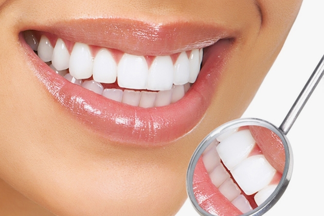Tẩy trắng răng bằng đèn Plasma tại Nha khoa Á Âu