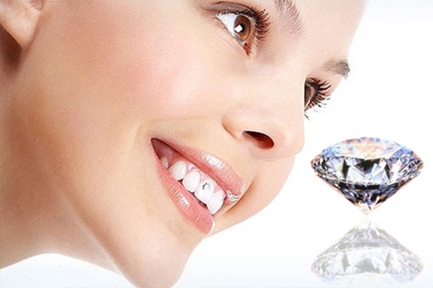 Đính Kim cương lên răng tại Nha khoa Family Dental