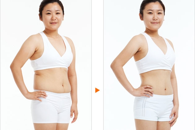 Giảm béo hiệu quả bằng phương pháp hỏa lực, ấn huyệt bao tử tại Hân Spa