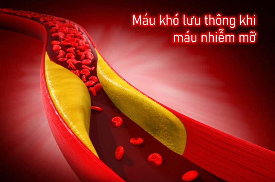 mau-nhiem-mo